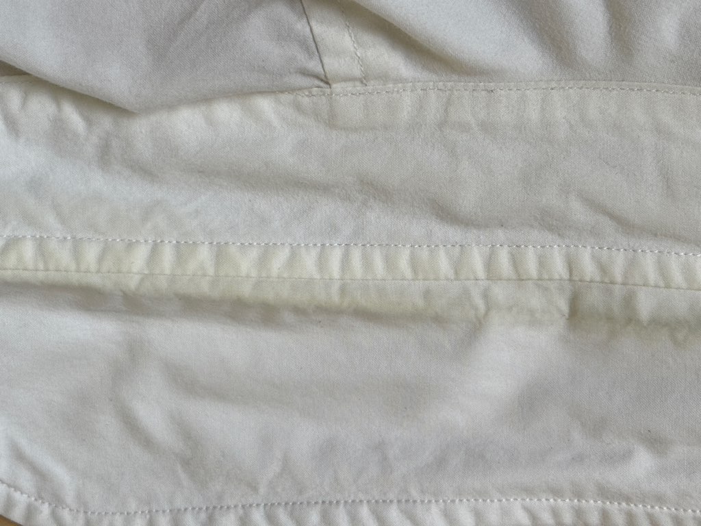 黄ばみが目立つ襟